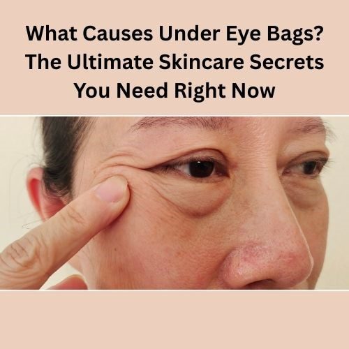 What Causes Under Eye Bags? The Ultimate Skincare Secrets You Need Right Now