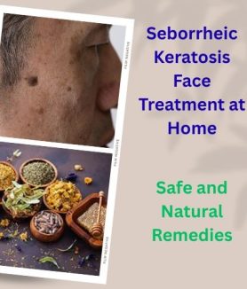 castor oil for seborrheic keratosis​