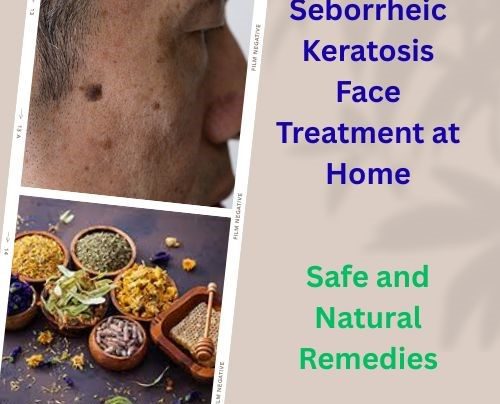 castor oil for seborrheic keratosis​