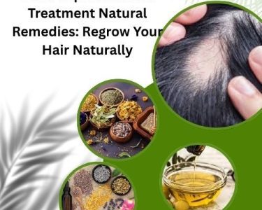 Alopecia Areata Treatment Natural Remedies: