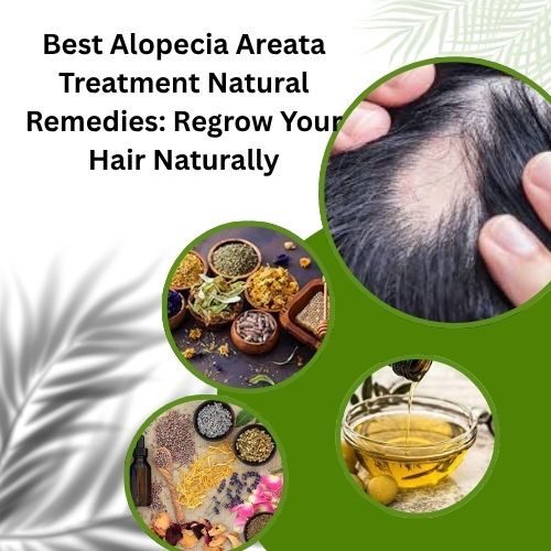 Best Alopecia Areata Treatment Natural Remedies: Regrow Your Hair Naturally