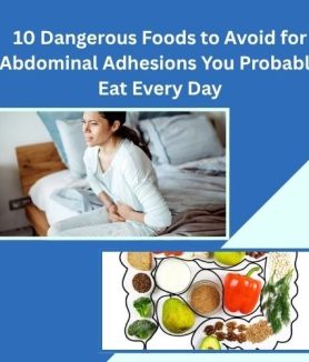 Foods to Avoid for Abdominal Adhesions