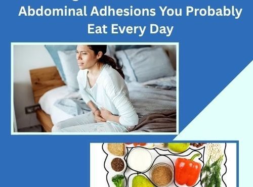 Foods to Avoid for Abdominal Adhesions
