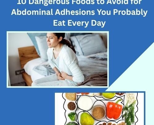 Foods to Avoid for Abdominal Adhesions