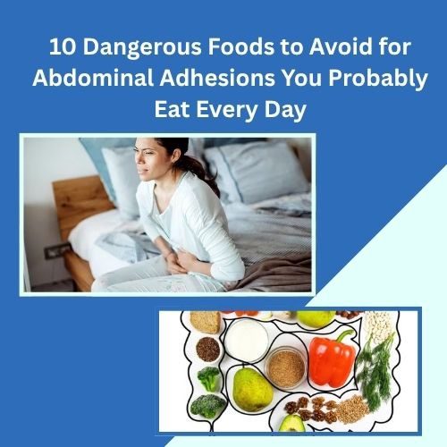 10 Dangerous Foods to Avoid for Abdominal Adhesions You Probably Eat Every Day