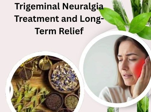herbs for trigeminal neuralgia treatment​