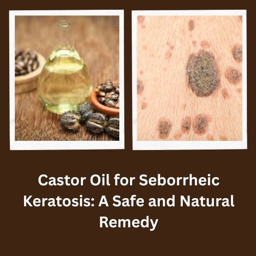Seborrheic Keratosis Face Treatment: Natural Remedies and the Power of Castor Oil