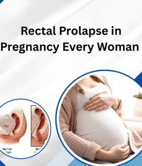 Rectal Prolapse in Pregnancy