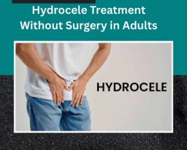 Hydrocele Treatment Without Surgery in Adults