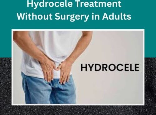Hydrocele Treatment Without Surgery in Adults