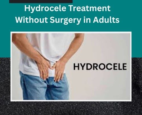 Hydrocele Treatment Without Surgery in Adults