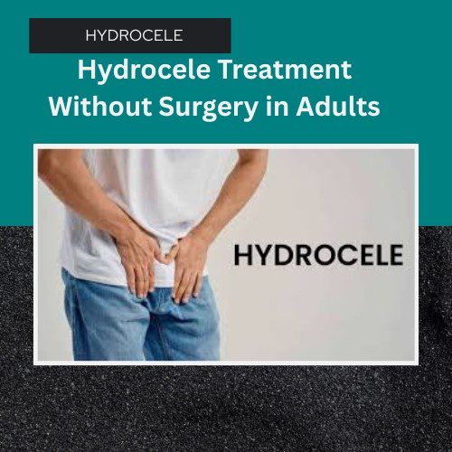 Effective Hydrocele Treatment Without Surgery in Adults: New Hope for Men