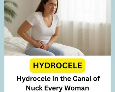 Hydrocele in the Canal of Nuck