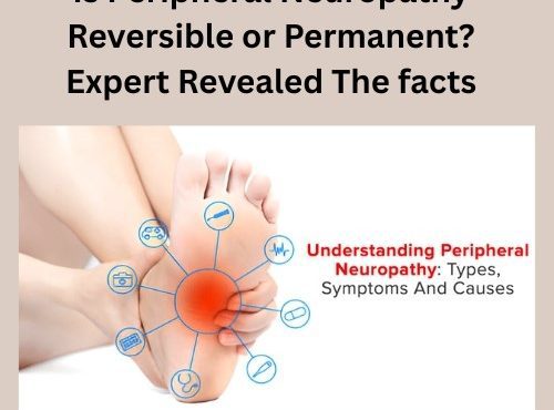 Is Peripheral Neuropathy Reversible