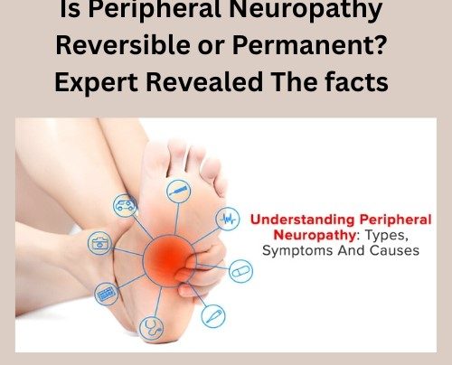 Is Peripheral Neuropathy Reversible