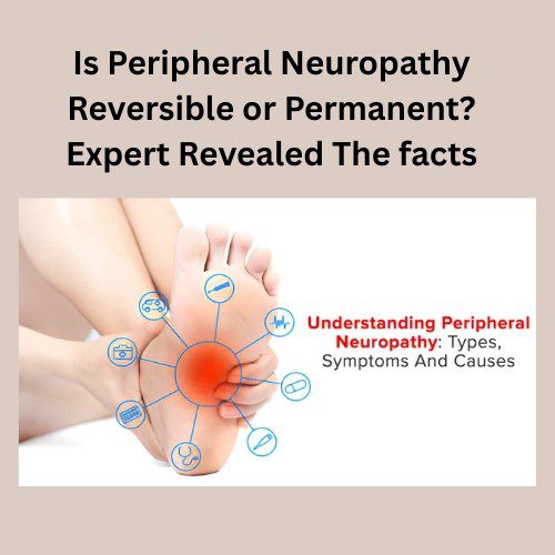 Is Peripheral Neuropathy Reversible or Permanent? Expert Revealed the Facts