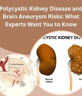Polycystic Kidney Disease and Brain Aneurysm Risks