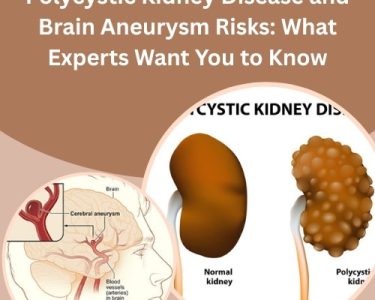 Polycystic Kidney Disease and Brain Aneurysm Risks