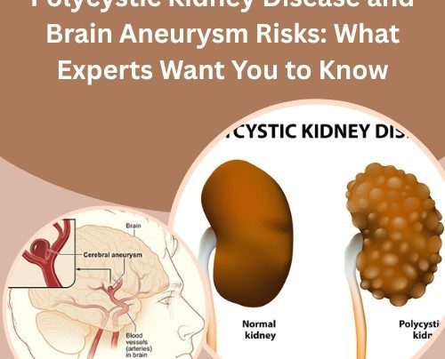 Polycystic Kidney Disease and Brain Aneurysm Risks