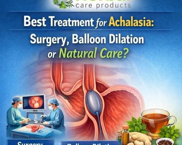 Best Treatment for Achalasia