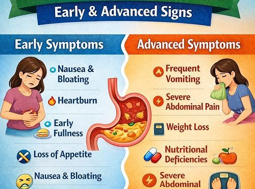 Gastroparesis Symptoms