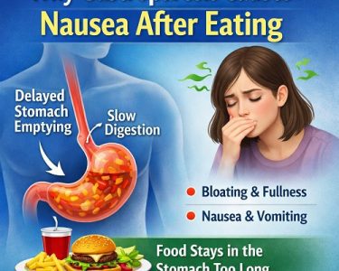 Gastroparesis Causes Nausea