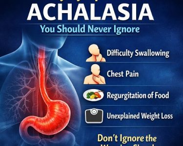 Early Symptoms of Achalasia