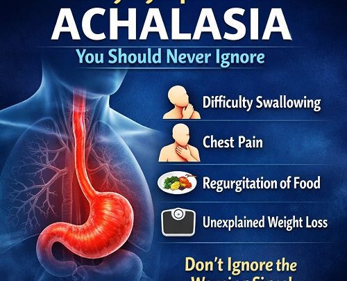 Early Symptoms of Achalasia