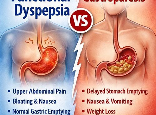 Functional Dyspepsia