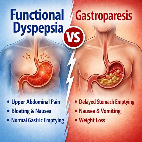 Functional Dyspepsia vs Gastroparesis