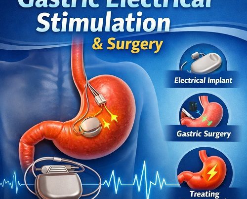 Gastric Electrical Stimulation & Surgery