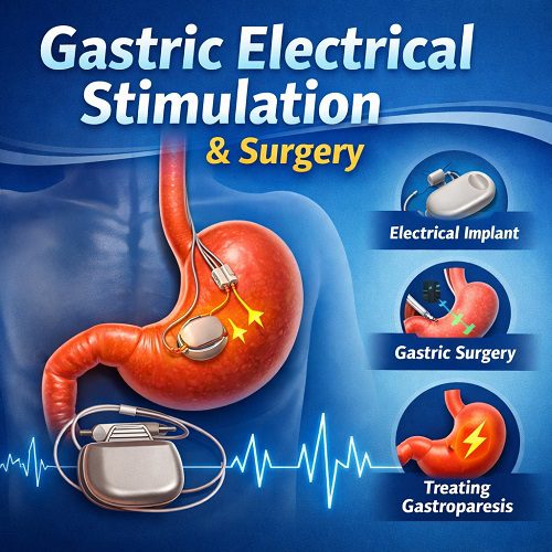Gastric Electrical Stimulation & Surgery