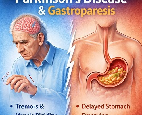 Parkinson’s Disease & Gastroparesis