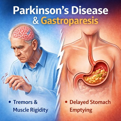 Parkinson’s Disease & Gastroparesis