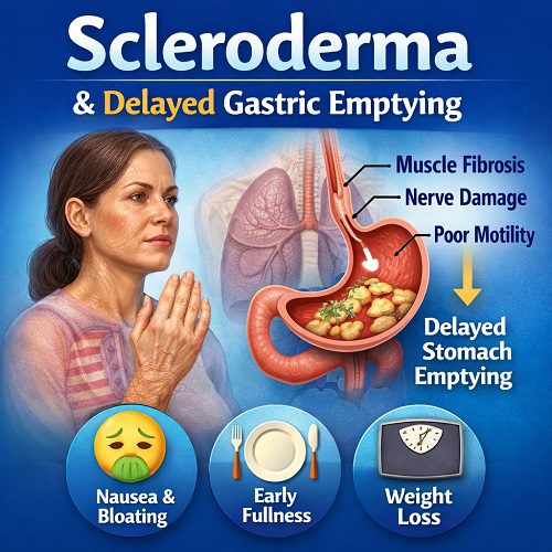 Scleroderma & Delayed Gastric Emptying