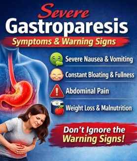 Severe Gastroparesis Symptoms & Warning Signs