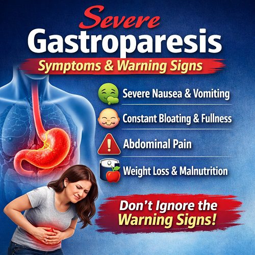 Severe Gastroparesis Symptoms & Warning Signs