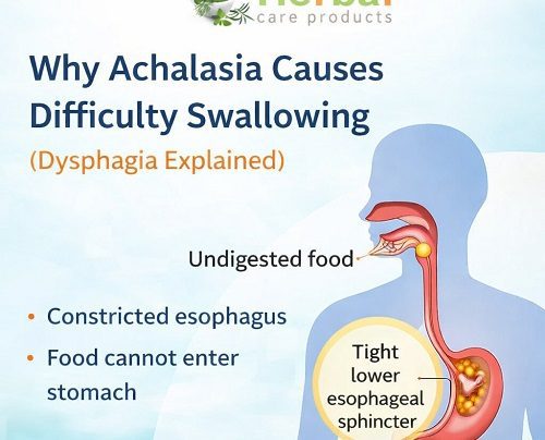 achalasia causes difficulty swallowing