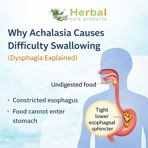 Why Achalasia Causes Difficulty Swallowing (Dysphagia Explained)