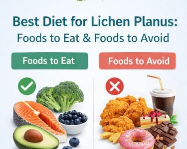 Lichen Planus diet