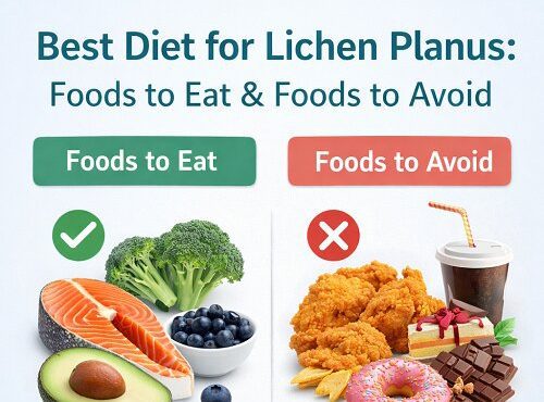 Lichen Planus diet