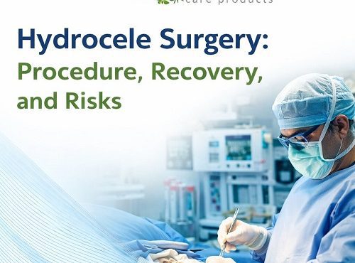 Hydrocele Surgery