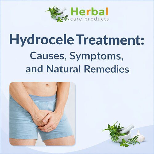Hydrocele Treatment: Causes, Symptoms, and Natural Remedies