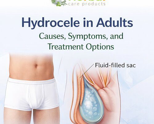 Hydrocele in Adults