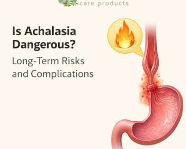 achalasia complications