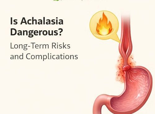 achalasia complications