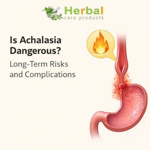 Is Achalasia Dangerous? Long-Term Risks and Complications