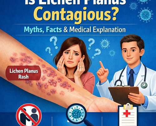 Is lichen planus contagious