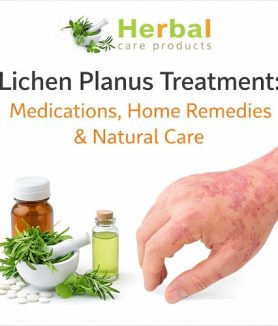 Lichen Planus Treatment