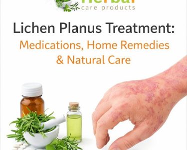 Lichen Planus Treatment